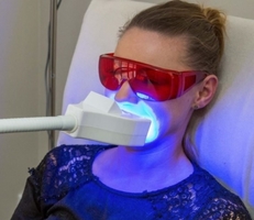 Teeth Whitening